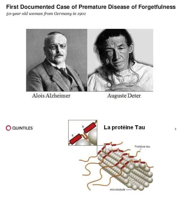 Alois Alzheimer - Auguste Deter Doctor Dinu